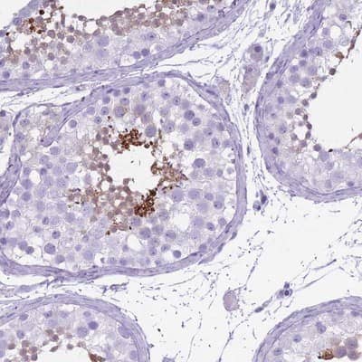 Immunohistochemistry-Paraffin: OR7C1 Antibody [NBP2-13714]