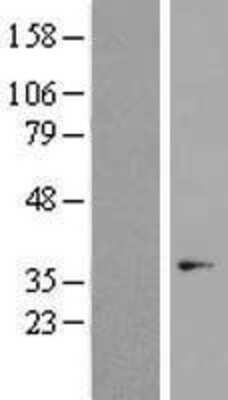 Western Blot: OR7C1 Overexpression Lysate [NBP2-04643]