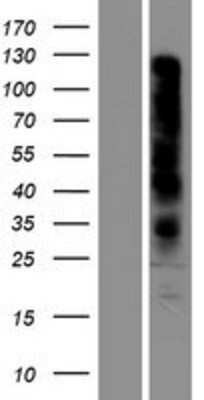 Western Blot: OR7D2 Overexpression Lysate [NBP2-05041]