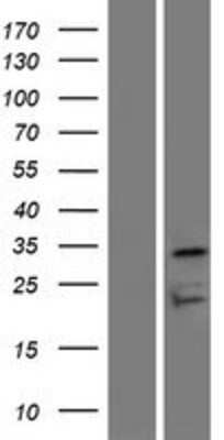 Western Blot: OR7D4 Overexpression Lysate [NBP2-08916]