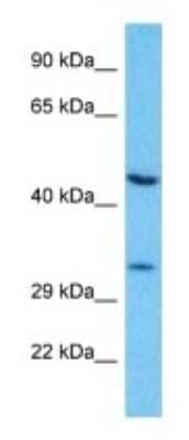 Western Blot: OR7G2 Antibody [NBP3-09814]