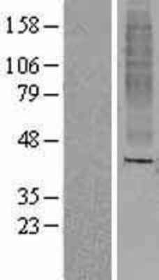 Western Blot: OR8A1 Overexpression Lysate [NBL1-13969]