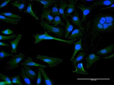 Immunocytochemistry/ Immunofluorescence: OR8B8 Antibody [H00026493-B01P]
