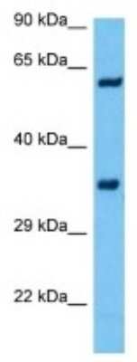 Western Blot: OR8B8 Antibody [NBP3-10237]