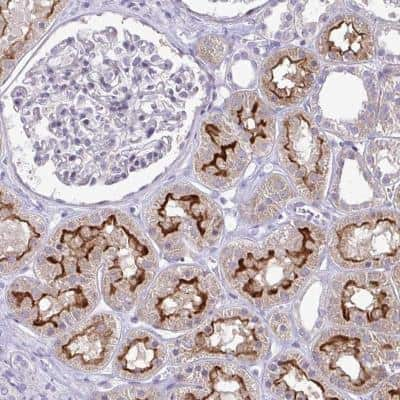 Immunohistochemistry-Paraffin: OR8D1 Antibody [NBP2-32472]