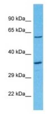 Western Blot: OR8D2 Antibody [NBP3-09823]