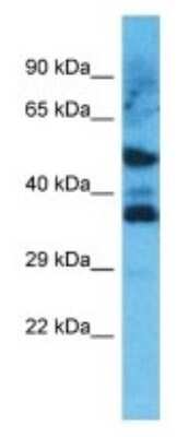 Western Blot: OR8D4 Antibody [NBP3-09824]