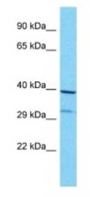 Western Blot: OR8G1 Antibody [NBP3-09825]