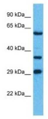 Western Blot: OR8H1 Antibody [NBP3-09827]