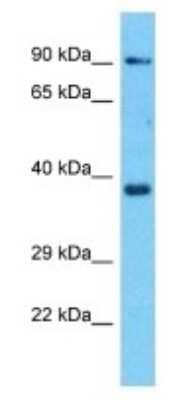 Western Blot: OR8H3 Antibody [NBP3-09828]