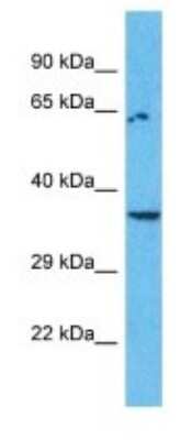 Western Blot: OR8I2 Antibody [NBP3-09829]