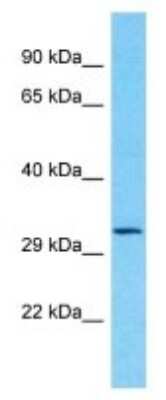 Western Blot: OR8J1 Antibody [NBP3-09830]