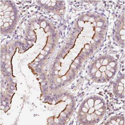 Immunohistochemistry: OR8K1 Antibody [NBP2-30786]