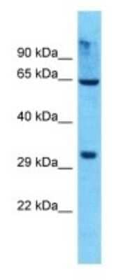 Western Blot: OR8K5 Antibody [NBP3-09831]