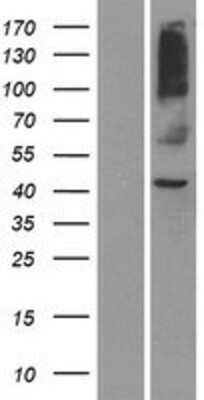 Western Blot: OR8S1 Overexpression Lysate [NBP2-08876]