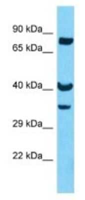 Western Blot: OR8U8 Antibody [NBP3-09834]