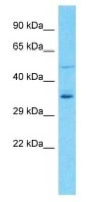 Western Blot: OR8U9 Antibody [NBP3-09833]