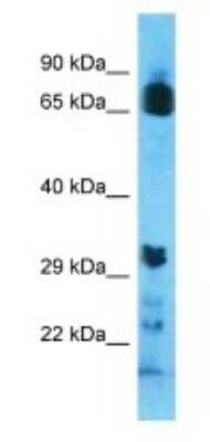 Western Blot: OR8U9 Antibody [NBP3-09835]