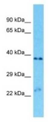 Western Blot: OR9A2 Antibody [NBP3-09836]