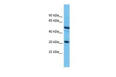 Western Blot: OR9G1 Antibody [NBP3-09796]