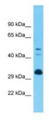 Western Blot: OR9G1 Antibody [NBP3-09837]