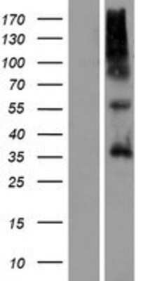 Western Blot: OR9G4 Overexpression Lysate [NBP2-08884]