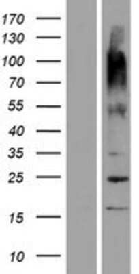 Western Blot: OR9G9 Overexpression Lysate [NBP2-08718]