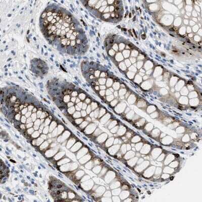 Immunohistochemistry: OR9K2 Antibody [NBP2-32000]