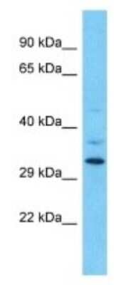 Western Blot: OR9Q1 Antibody [NBP3-09840]