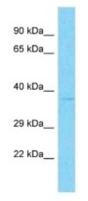 Western Blot: OR9Q2 Antibody [NBP3-09841]