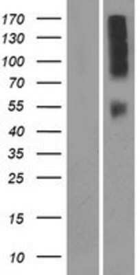 Western Blot: OR9Q2 Overexpression Lysate [NBP2-08883]