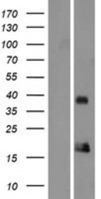 Western Blot: ORAOV1 Overexpression Lysate [NBP2-05251]