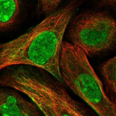 Immunocytochemistry/ Immunofluorescence: ORC1 Antibody [NBP1-83184]