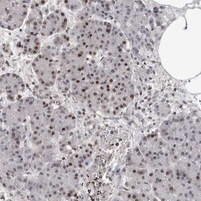 Immunohistochemistry-Paraffin: ORC1 Antibody [NBP1-83184]