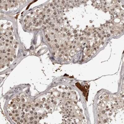 Immunohistochemistry-Paraffin: ORC1 Antibody [NBP1-83184]
