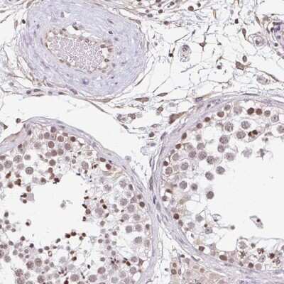 Immunohistochemistry-Paraffin: ORC3L Antibody [NBP2-49097]