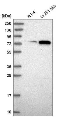 Western Blot: ORC3L Antibody [NBP2-55490]