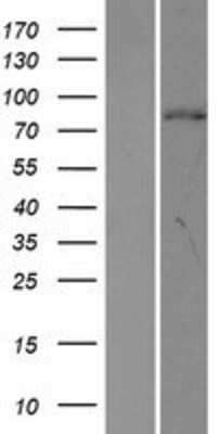 Western Blot: ORC3L Overexpression Lysate [NBP2-10357]