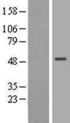 Western Blot: ORC4L Overexpression Lysate [NBL1-13975]