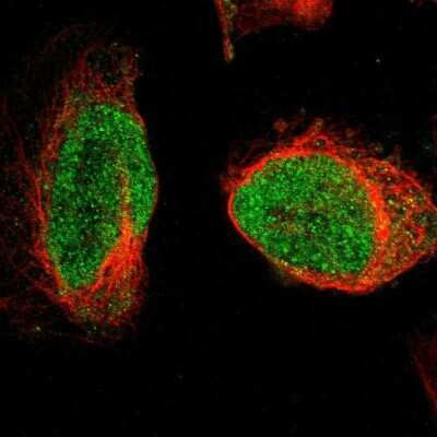 Immunocytochemistry/ Immunofluorescence: ORC5L Antibody [NBP1-82476]