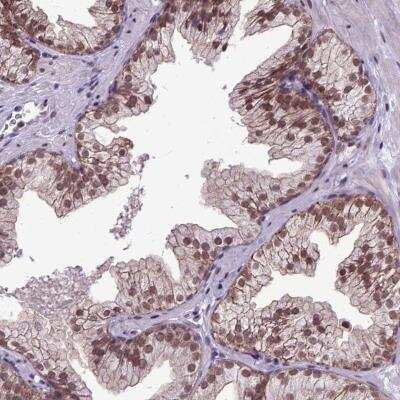 Immunohistochemistry: ORC5L Antibody [NBP1-82476]