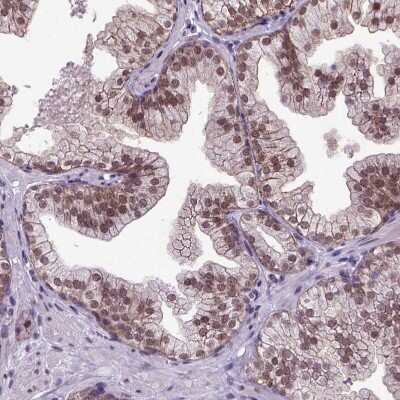 Immunohistochemistry-Paraffin: ORC5L Antibody [NBP1-82476]