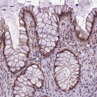 Immunohistochemistry-Paraffin: ORC5L Antibody [NBP1-82476]
