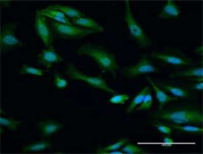 Immunocytochemistry/ Immunofluorescence: ORC6L Antibody [H00023594-D01P]