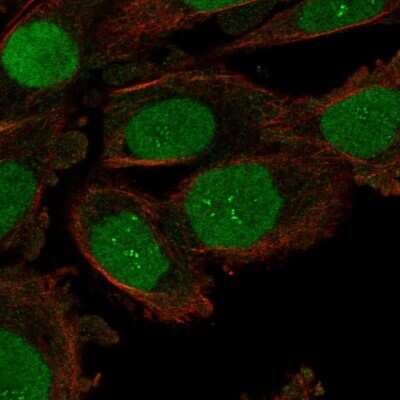 Immunocytochemistry/ Immunofluorescence: ORC6L Antibody [NBP2-57470]