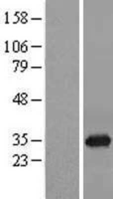 Western Blot: ORC6L Overexpression Lysate [NBL1-13977]