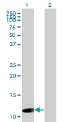 Western Blot: ORF1 FL49 Antibody (4E11) [H00084418-M02]