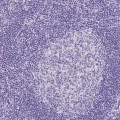 Immunohistochemistry-Paraffin: ORF1 FL49 Antibody [NBP2-13898]