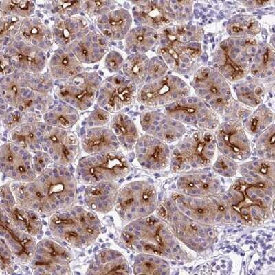Immunohistochemistry-Paraffin: ORF1 FL49 Antibody [NBP2-13898]