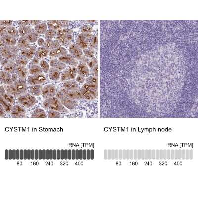 Immunohistochemistry-Paraffin: ORF1 FL49 Antibody [NBP2-13898]